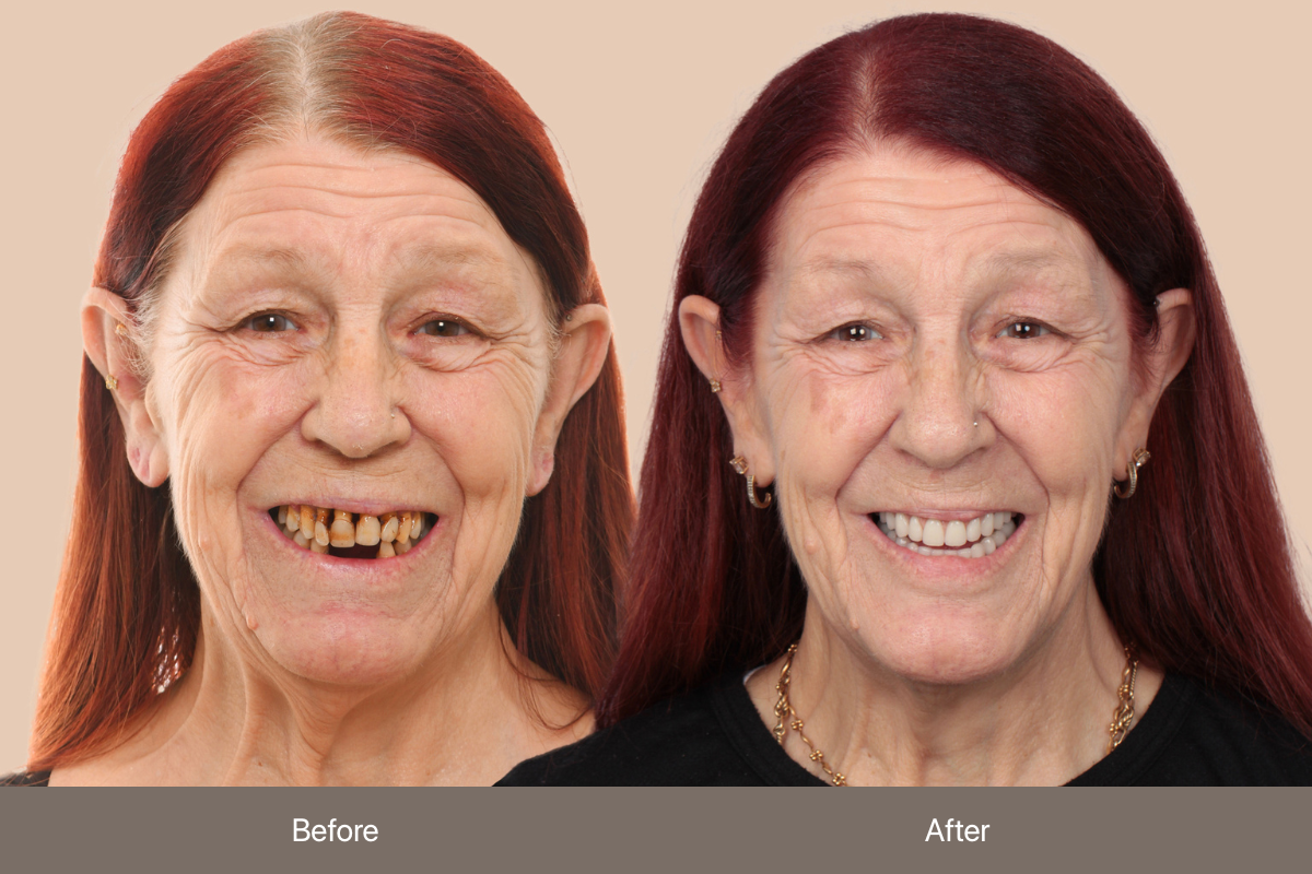 BEFORE & AFTER_Margaret_PER (3)